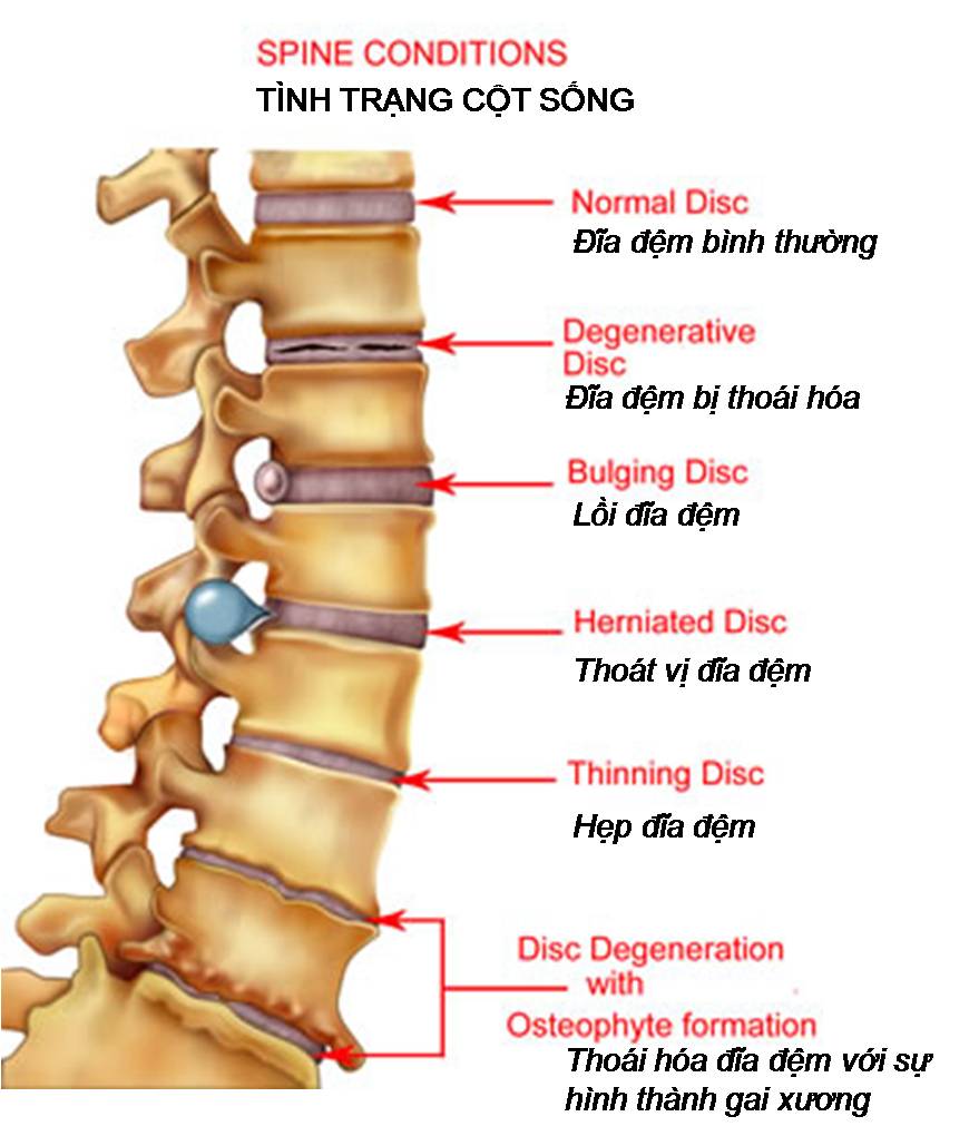 Việt Y cổ truyền chữa trị các bệnh Xương Khớp