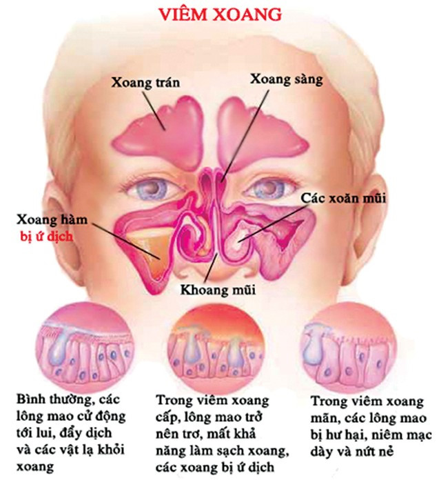 Vị trí của các xoang trên cơ thể